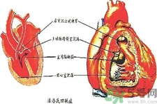 先天性心臟病可以用藥物治療嗎？