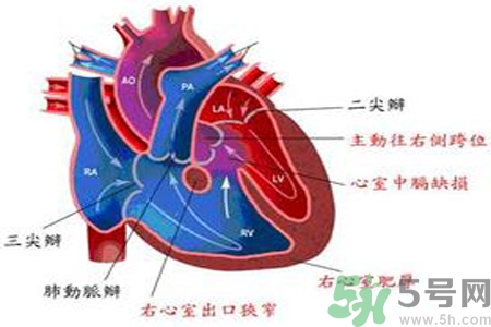 先天性心臟病需要注意什么？