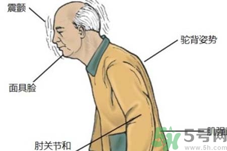 帕金森要注意哪些措施？帕金森的飲食需注意什么？