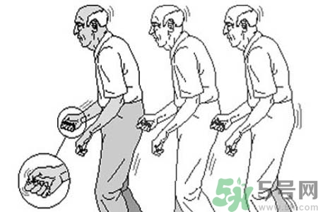帕金森要注意哪些措施？帕金森的飲食需注意什么？