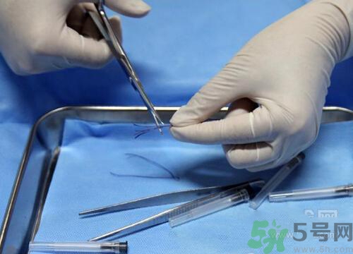 埋線減肥多少錢(qián)一次？埋線減肥的副作用