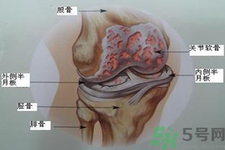 預防骨病需要注意哪些姿勢？秋季預防骨病的方法有哪些？