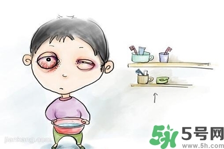 寶寶為什么會(huì)感染紅眼病？寶寶患紅眼病如何治療？