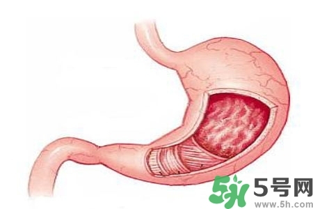 急性腸胃炎哪些食物不可以吃？急性腸胃炎不能吃的水果有？