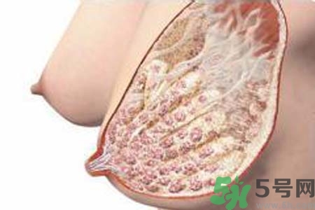 乳腺增生治療方法是什么？乳腺增生的檢查方法有哪些？