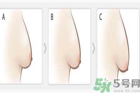 胸部松弛的原因是什么？胸部松弛該怎么辦？