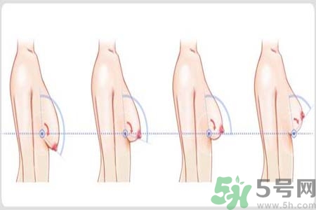 胸部松弛的原因是什么？胸部松弛該怎么辦？
