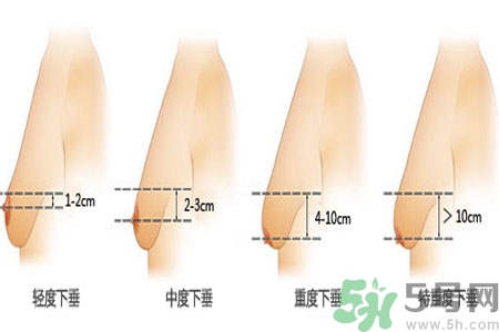 胸部松弛的原因是什么？胸部松弛該怎么辦？