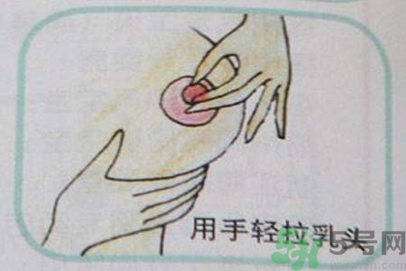 乳頭內陷怎么回事？乳頭內陷的原因是什么？