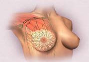 乳頭發(fā)黑是怎么回事？乳頭發(fā)黑是什么原因？