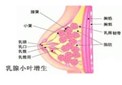 乳腺增生治療方法是什么？乳腺增生的檢查方法有哪些？
