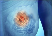 乳房有硬塊正常嗎？乳房有腫塊怎么回事？