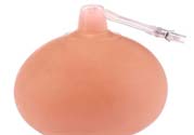 乳頭內(nèi)陷可以拔罐嗎？乳頭內(nèi)陷需要手術(shù)治療嗎？