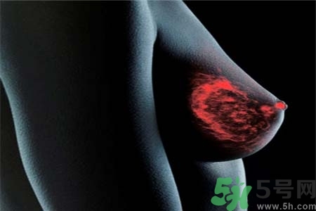 乳房上有硬塊怎么辦？乳房有硬塊的病因是什么？