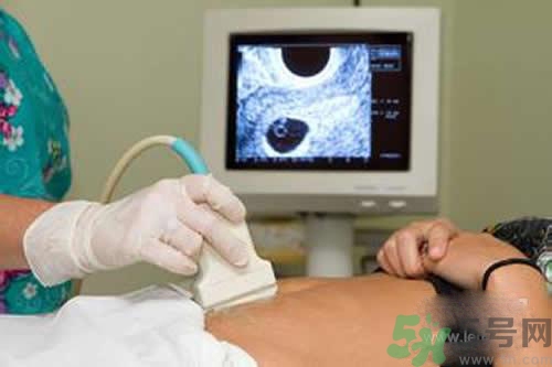 孕婦做b超要空腹嗎？孕婦做b超要不要空腹？
