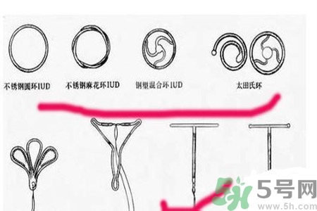 什么是宮內(nèi)節(jié)育器？放置宮內(nèi)節(jié)育器為什么能避孕？