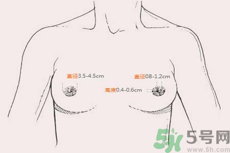 乳頭內(nèi)陷能不能喂奶？乳頭凹陷怎樣哺乳？