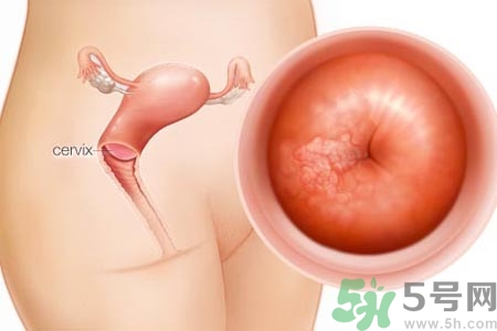 陰道干澀的原因是什么？陰道干澀怎么辦？
