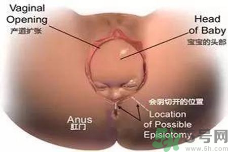 女性陰道松弛的原因是什么？女性陰道松弛怎么辦？