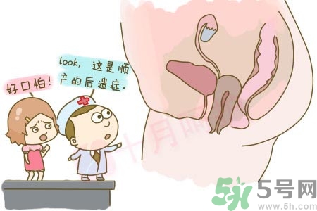 陰道松弛有什么危害？?陰道松弛恢復的方法有哪些？