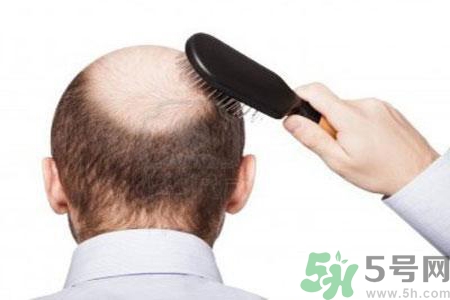 男性更年期的表現(xiàn)有哪些？怎么判斷男性更年期？