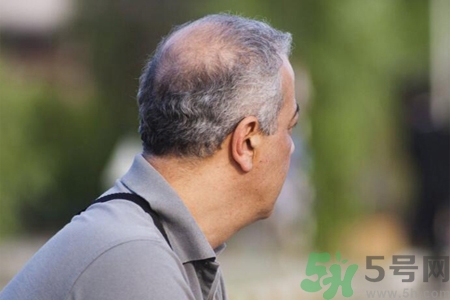 男性更年期的表現(xiàn)有哪些？怎么判斷男性更年期？