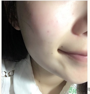 麗得姿面膜適合孕婦可以用嗎？麗得姿面膜哪些孕婦可以用？
