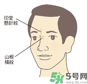耳垂上有豎紋是怎么回事？山根有橫紋是什么?。?></p><h3>山根</h3><p>鼻尖是臉部最高的部位，就像山峰一樣，而位於兩眼內側眼頭之間的鼻梁低處，是鼻子開始要隆起的地方，相對於鼻子高度最低，所以稱為「山根」，它與心臟關系最密切。正常的山根，高度應該與鼻子和面部的比例相合，而且要有隆起的樣子，光滑無橫紋，沒有青筋。</p><p>許多壯年猝死的人，如人稱科技游俠的溫世仁先生（腦干出血），藝人戎祥、馬兆駿（心肌梗塞）等，他們的山根都比較低陷，幾乎與兩側的眼頭一樣高。</p><p>●山根低陷或出現(xiàn)橫向細紋：山根低陷除非是外傷，否則通常是先天的結構；山根橫紋則常在身體使用多年、身心壓力大的中年以後出現(xiàn)，而且多兼有皺眉的習慣。</p><p>●山根青筋：較常出現(xiàn)在小孩子身上，表示曾受驚嚇，心神不安，睡覺時多會翻覆，情緒比較不太穩(wěn)定。</p><p style=