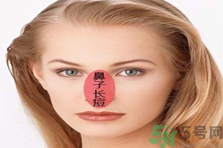 鼻翼長痘痘怎么辦？鼻翼長痘解決方法有哪些？