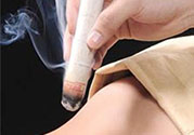 肩周炎艾灸有用嗎？肩周炎艾灸哪些部位？