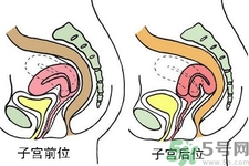 子宮移位的原因是什么？子宮移位的癥狀有哪些？