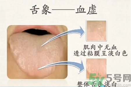血虛怎么調(diào)理？女人血虛怎么調(diào)理？