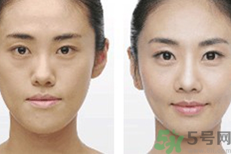 激光縮毛孔多少錢(qián)一次？激光縮毛孔一個(gè)療程多少錢(qián)？