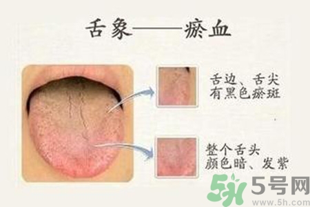 血瘀體質(zhì)吃什么？血瘀體質(zhì)怎么調(diào)理？