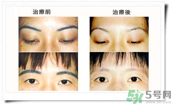 紋眉毛有什么危害？紋眉后注意事項(xiàng)