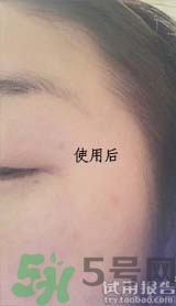dr.jart適合什么年齡層？蒂佳婷適合年齡