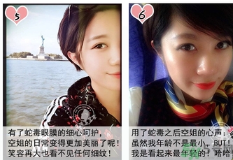 蛇毒眼膜孕婦可以用嗎？ 日本spa蛇毒眼膜孕婦能用嗎？