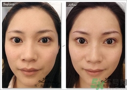 眉毛怎么整形好看？眉毛怎么整自然？