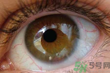 ?干眼癥的治療方法是什么？如何預防干眼癥？