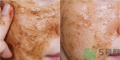 思親膚在韓國(guó)什么檔次？skin food在韓國(guó)怎么樣？