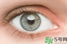 黑眼圈是怎么形成的？黑眼圈是什么原因引起的？