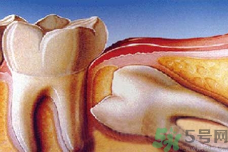 拔智齒一顆多少錢？拔除智齒收費(fèi)多少？