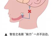 長智齒疼痛怎么辦？長智齒牙齦腫了怎么辦？