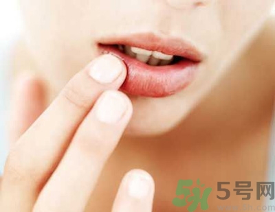 孕婦嘴唇干裂脫皮怎么回事？孕婦嘴唇干裂脫皮是缺什么