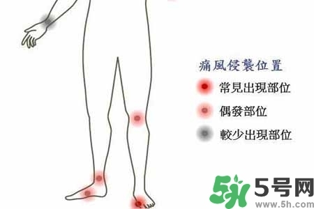 引發(fā)痛風的原因是什么？痛風病人飲食需注意什么好？