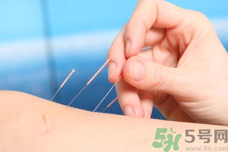 針灸一次要扎多長時(shí)間？針灸可以幾天做一次？