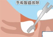 智齒拔完后有個(gè)洞怎么辦？拔智齒后有個(gè)洞多久能長好？