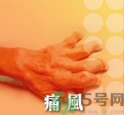 骨關(guān)節(jié)炎能治好嗎？骨關(guān)節(jié)炎平時(shí)注意事項(xiàng)