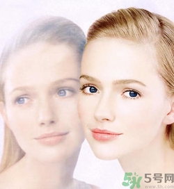曬斑可以自己消退嗎？曬斑可以用激光去除嗎？