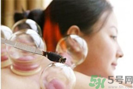 肩膀酸痛可以拔火罐嗎？孕婦肩膀酸痛能拔火罐嗎？